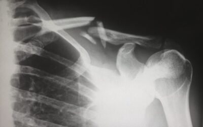 Signs You May be a Hypochondriac
